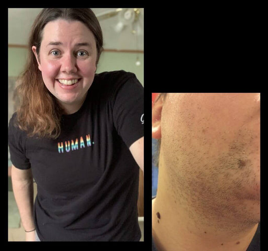 PCOS is Not a Death Sentence