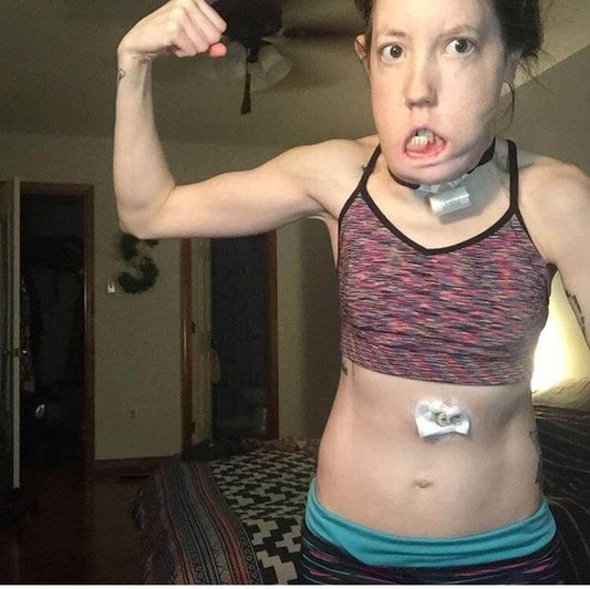 Feeding Tube Fitness